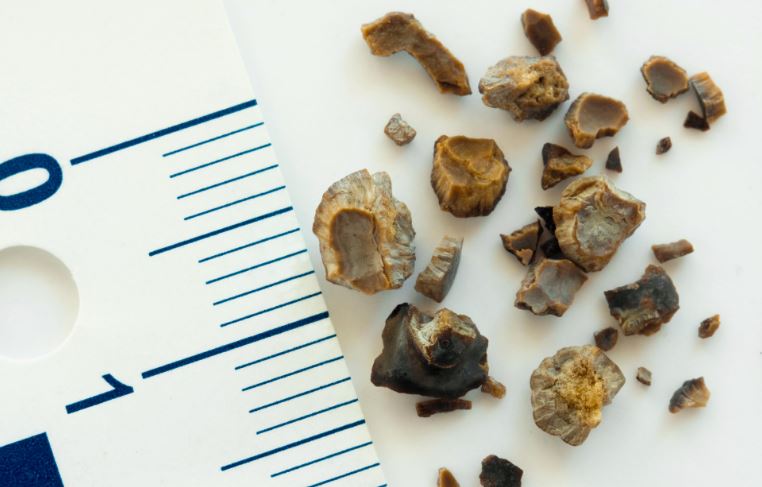 Preventing Kidney Stones in Pets
