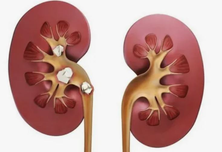 Understanding Signs of Kidney Stones in Your Pet