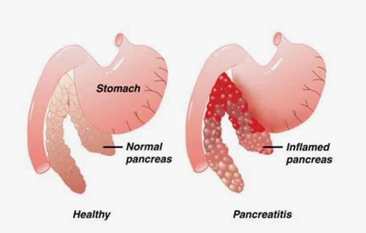symptoms of pancreatitis in dogs